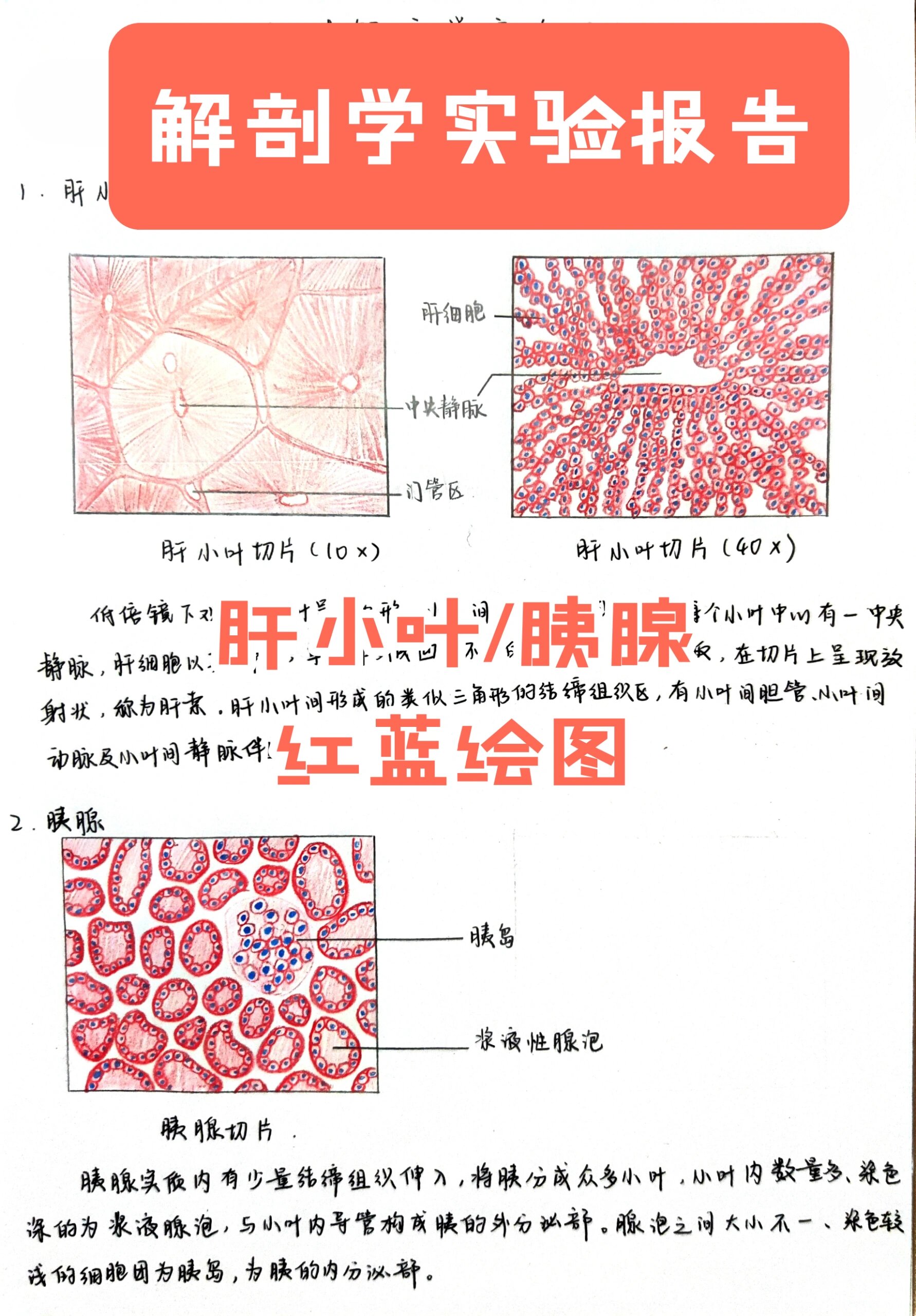 肝硬化手绘图实验报告图片