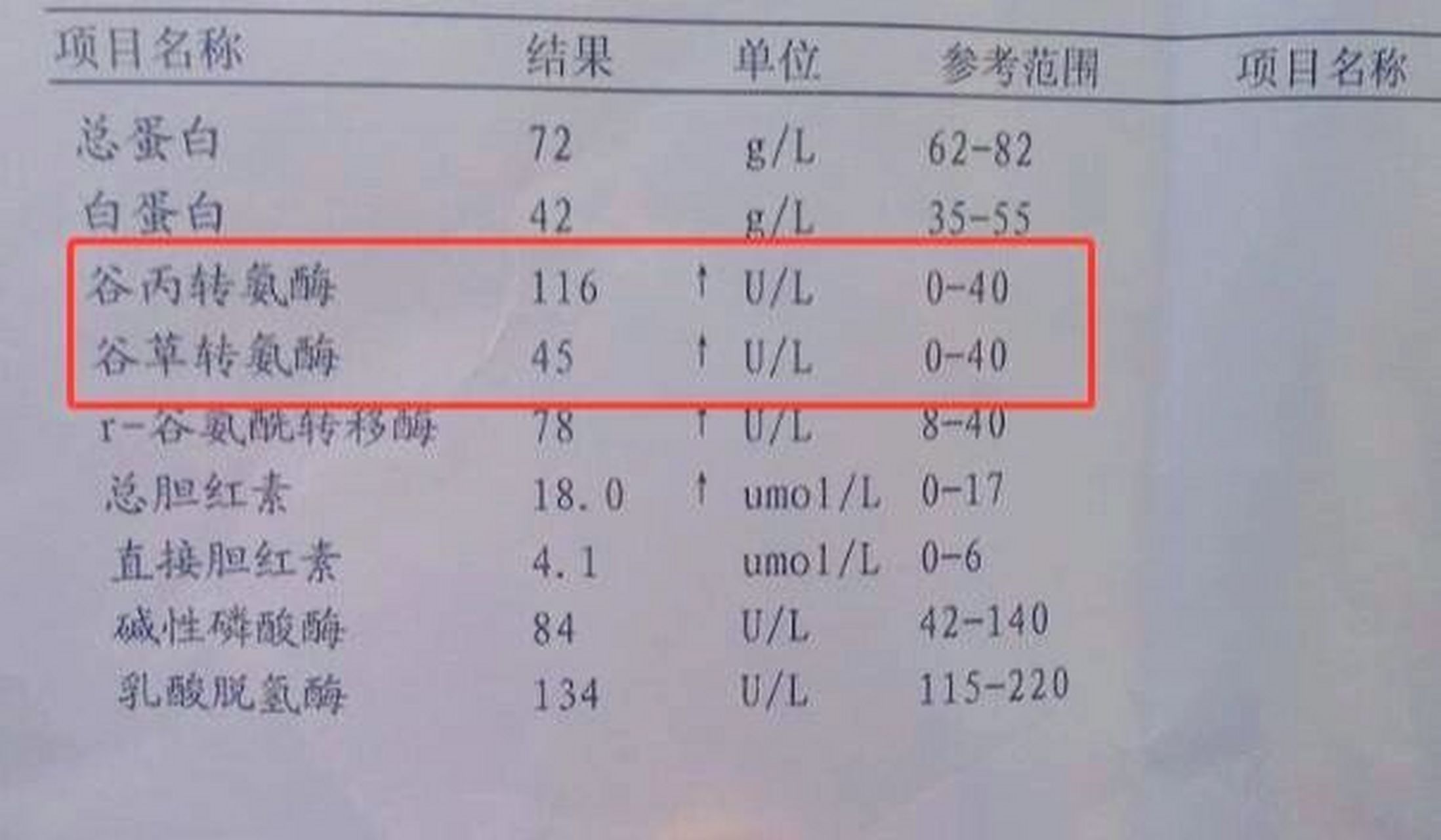 谷丙转氨酶和谷草转氨酶升高哪个更严重呢?