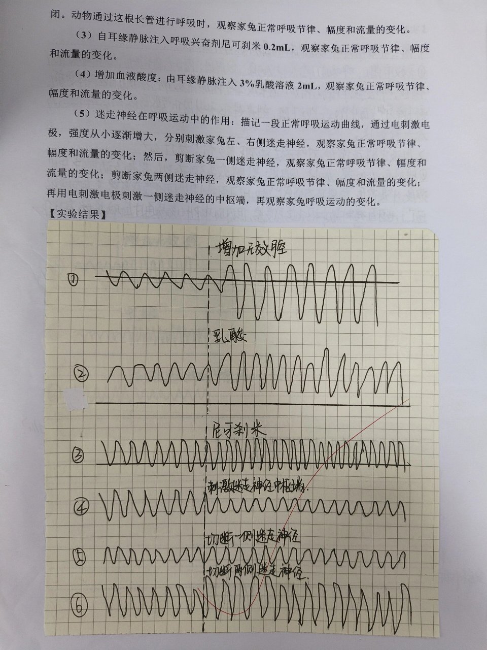 家兔正常血压曲线图图片