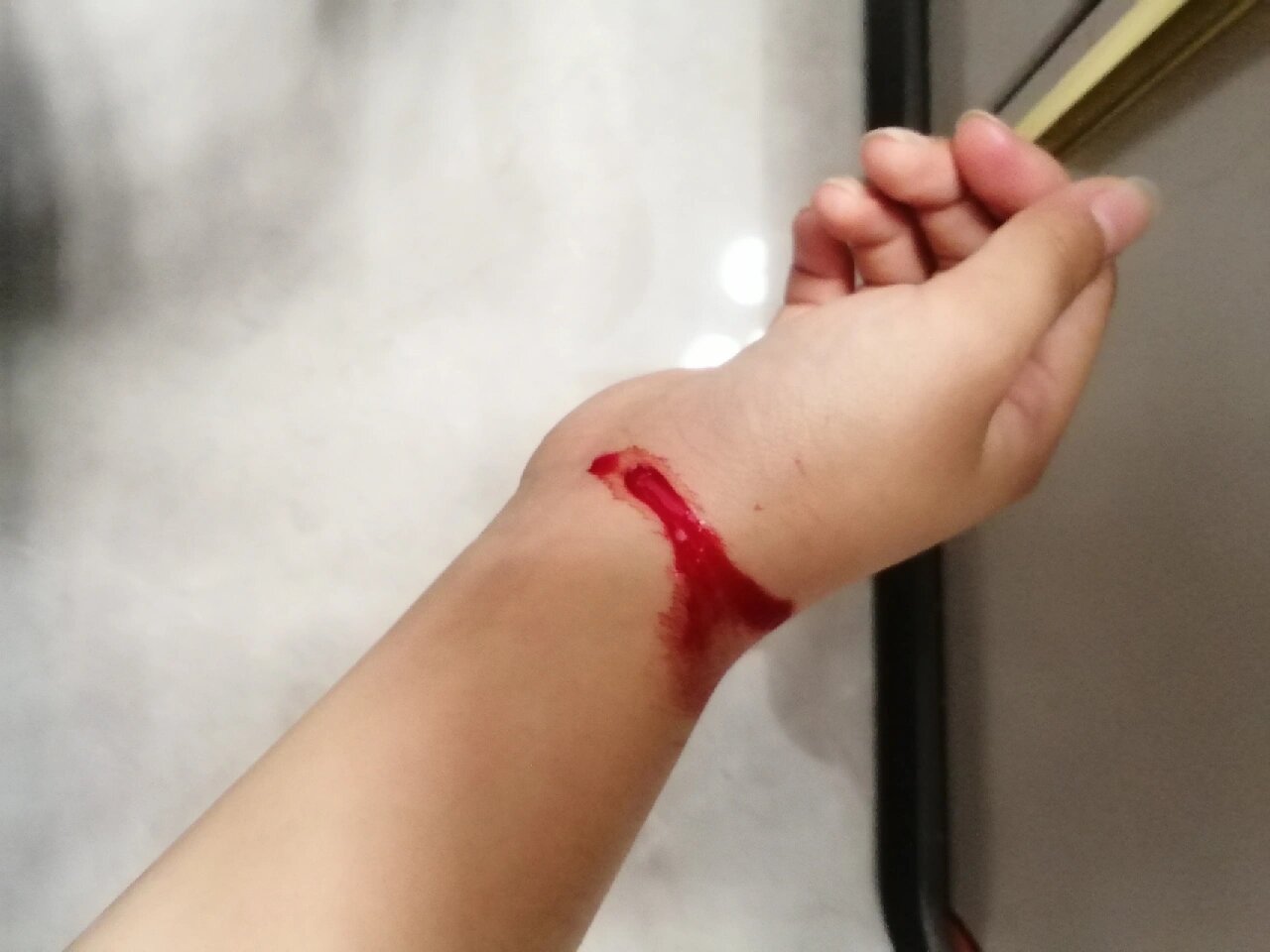 被菜刀切到手腕了快疼死了血一直流