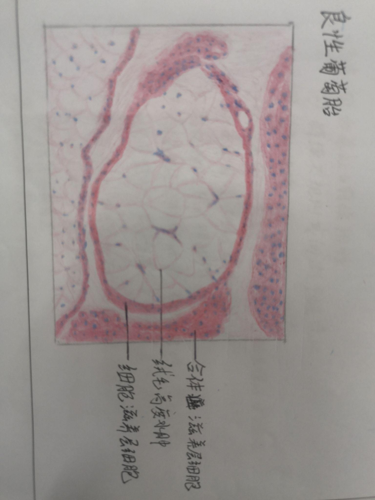 乙脑病理红蓝铅笔图图片