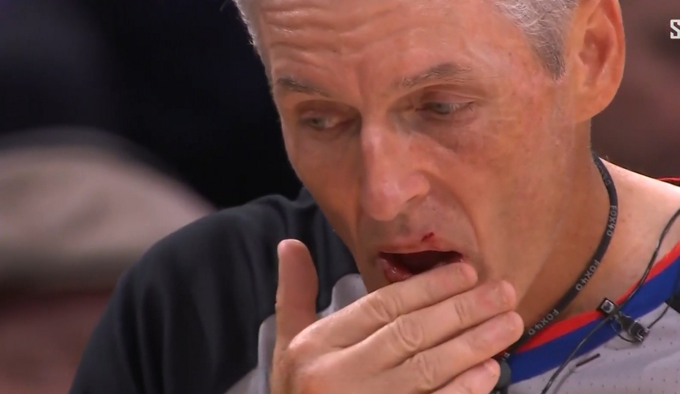 詹姆斯把裁判撞出血   詹姆斯快攻,不小心把裁判福斯特嘴角撞破了