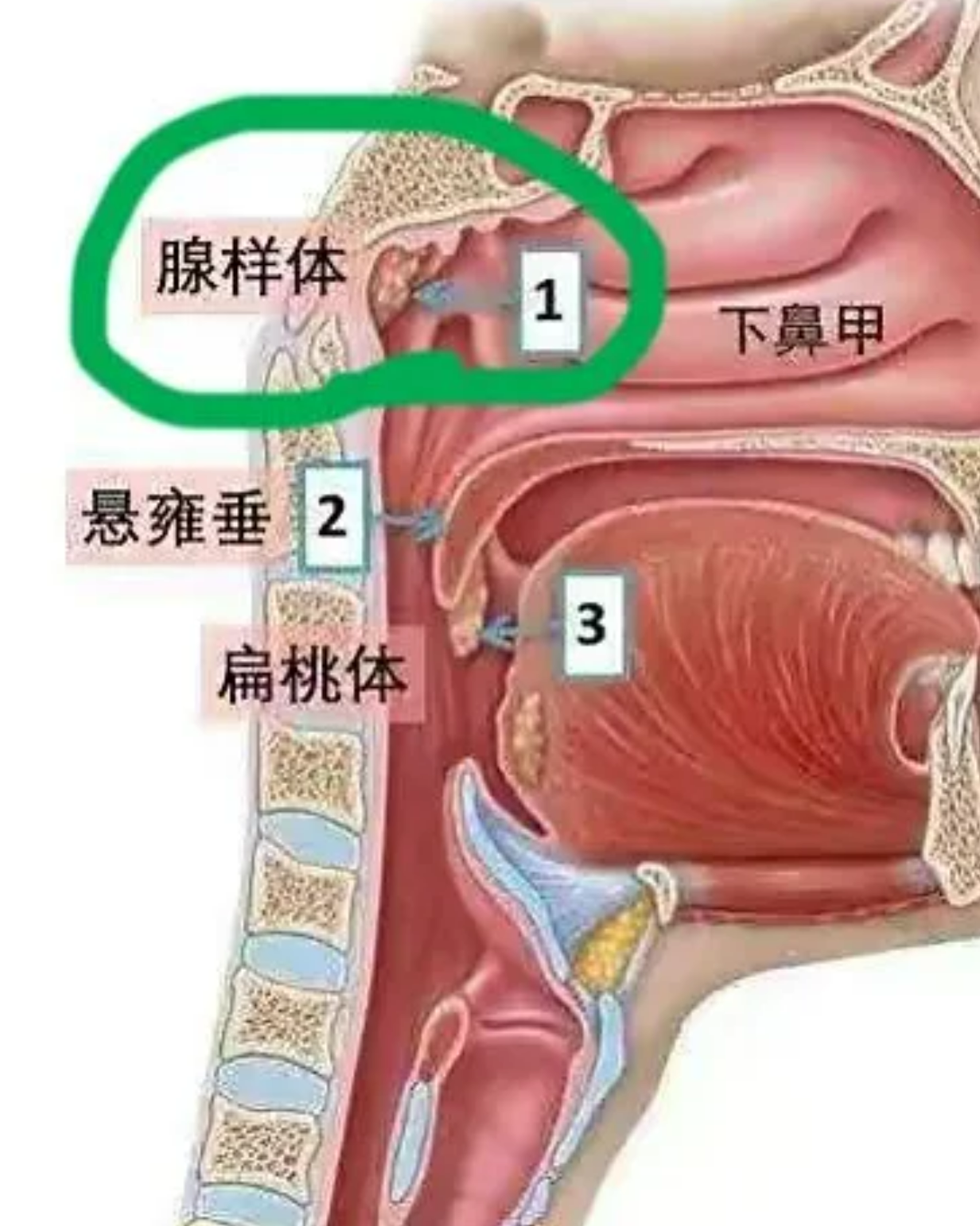腺样体长在鼻咽部,也就是鼻腔最后面