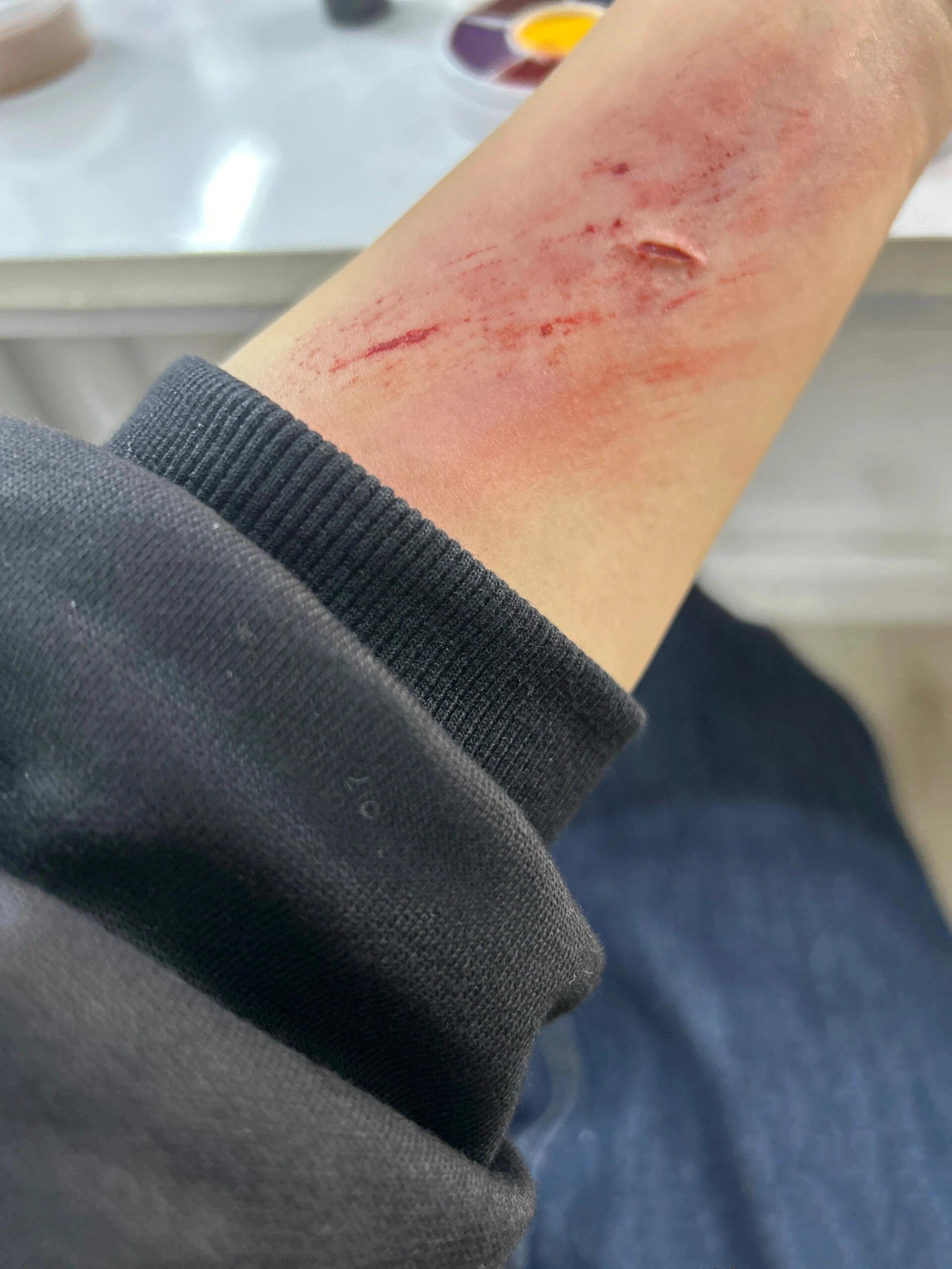 擦伤特效摔伤特效割腕特效