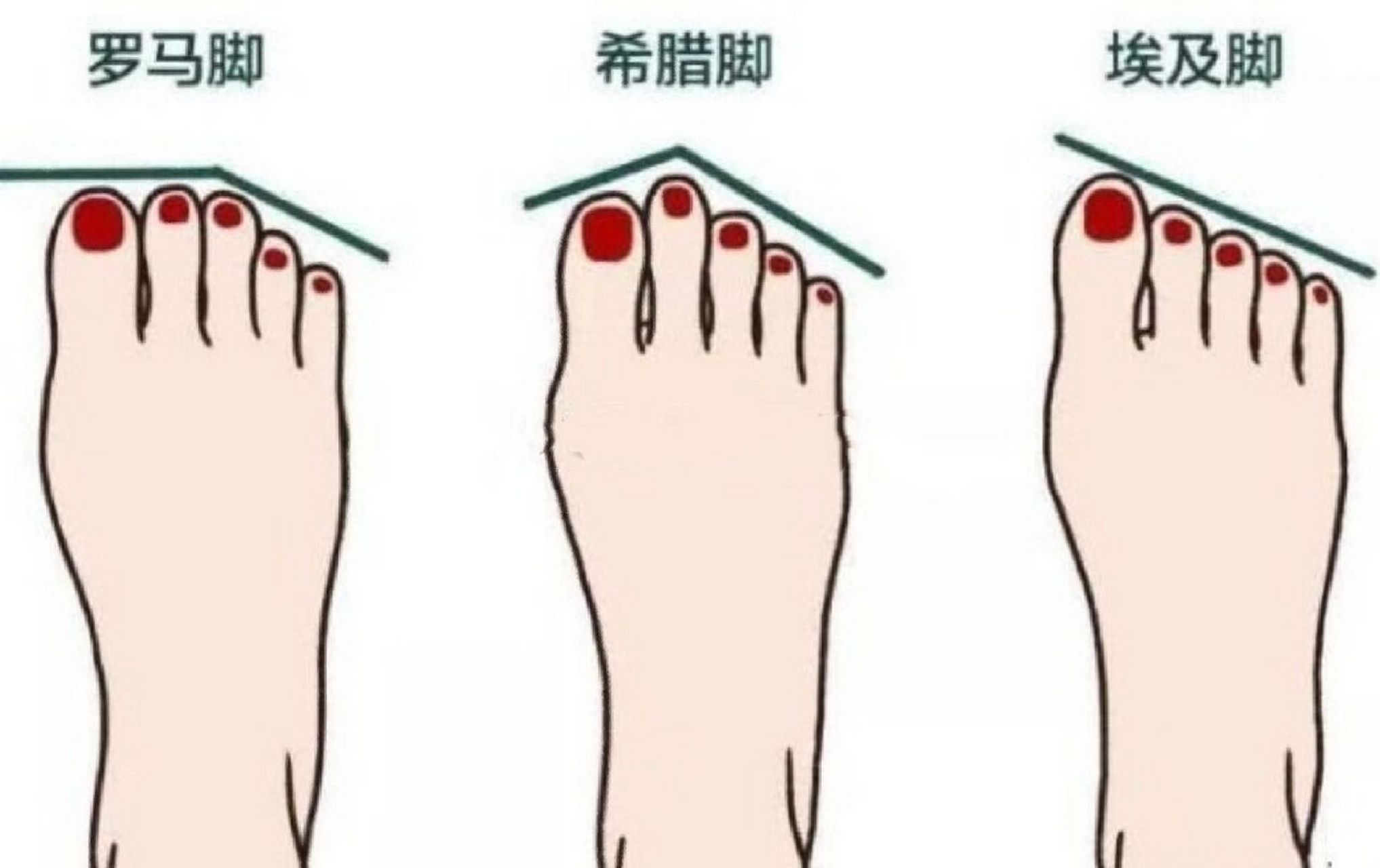 各种脚型及其运势 一,希腊脚 第二根脚趾最长的人我们称为希腊脚,具有