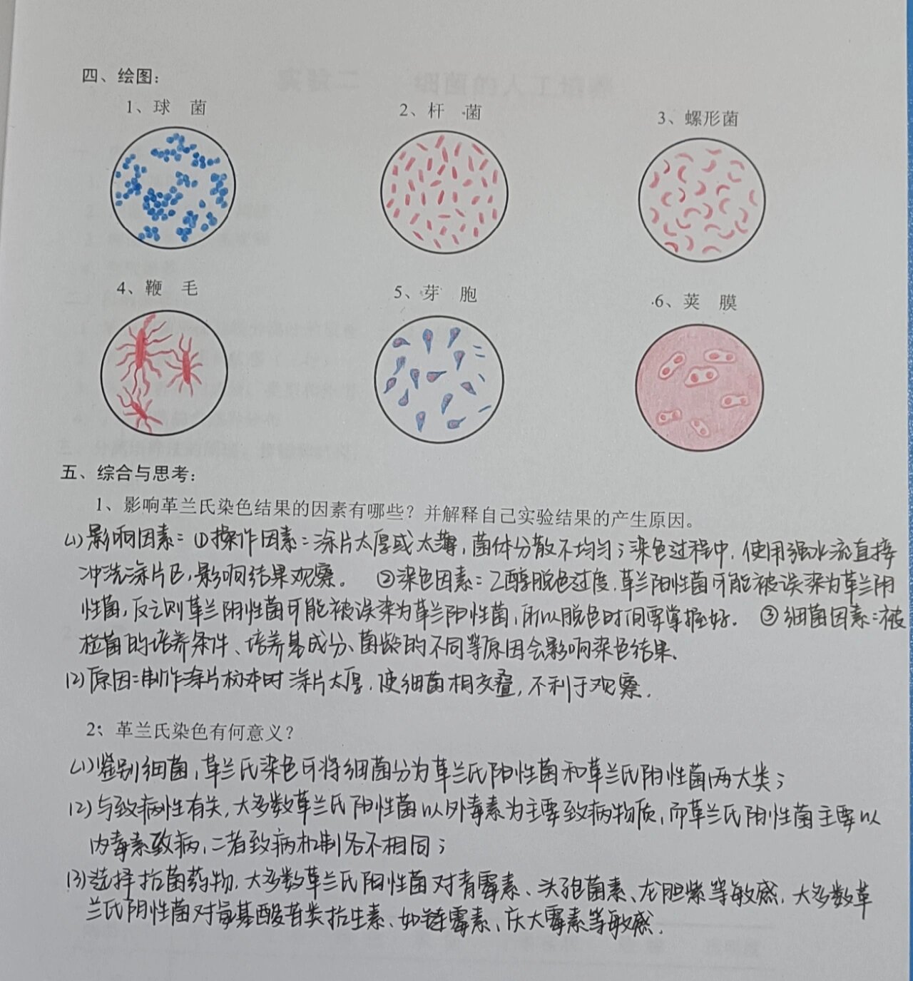 抗酸染色实验报告画图图片