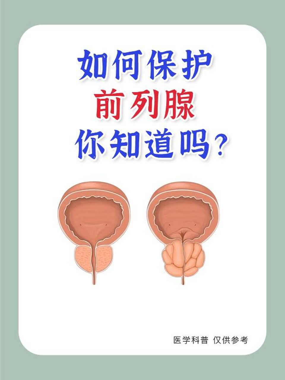如何保护前列腺呢?健康科普 男科健康科普 男科小知识