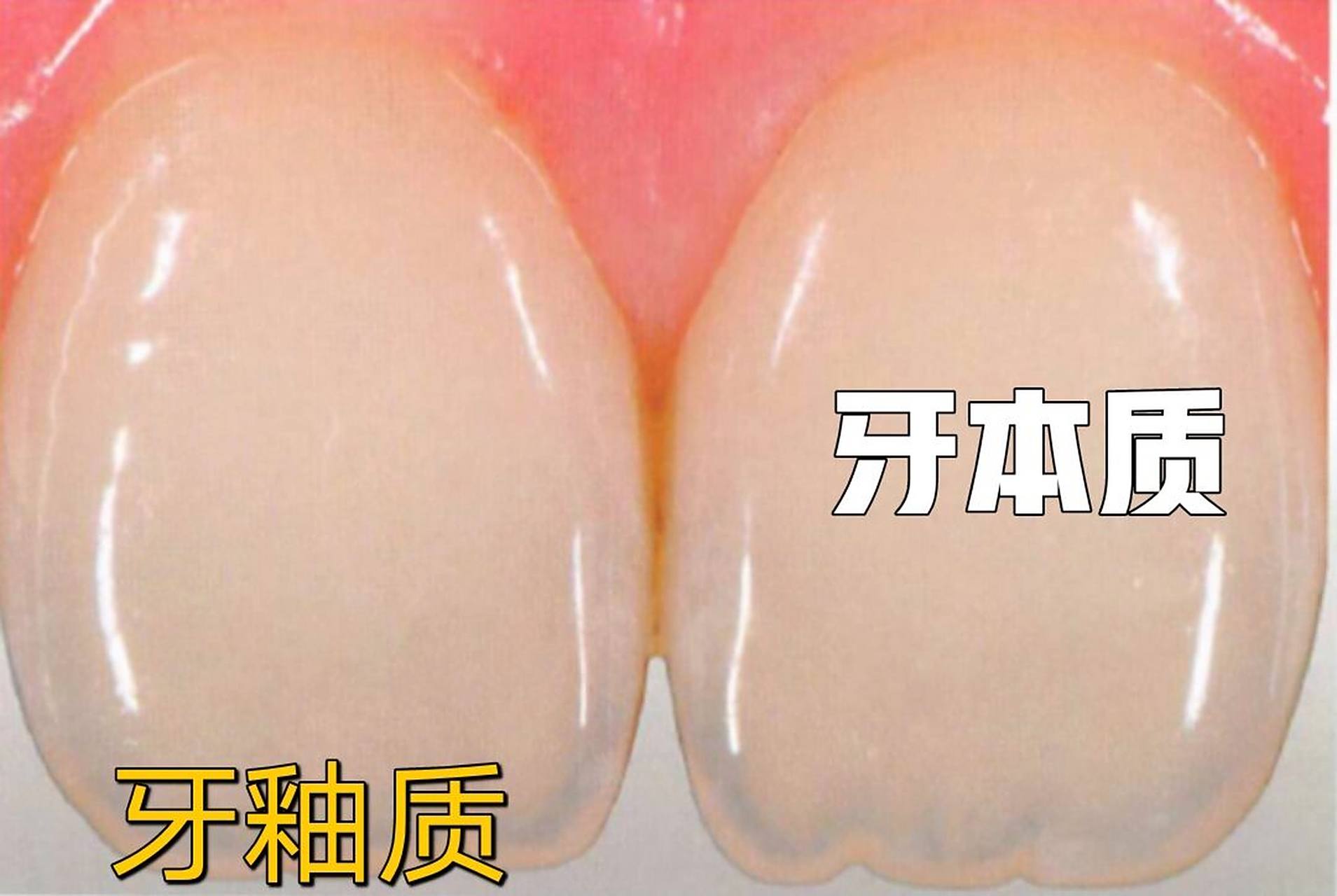 天然健康的牙齿颜色 牙齿具有多色性.