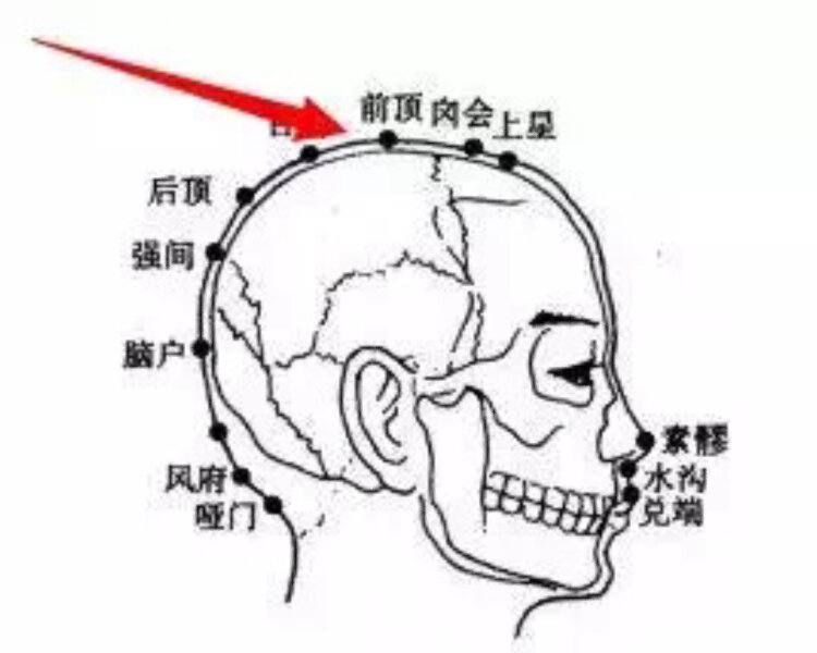 后顶穴:癫狂痫证,烦心,失眠【取穴位置】在头部,当后发际正中直上5.