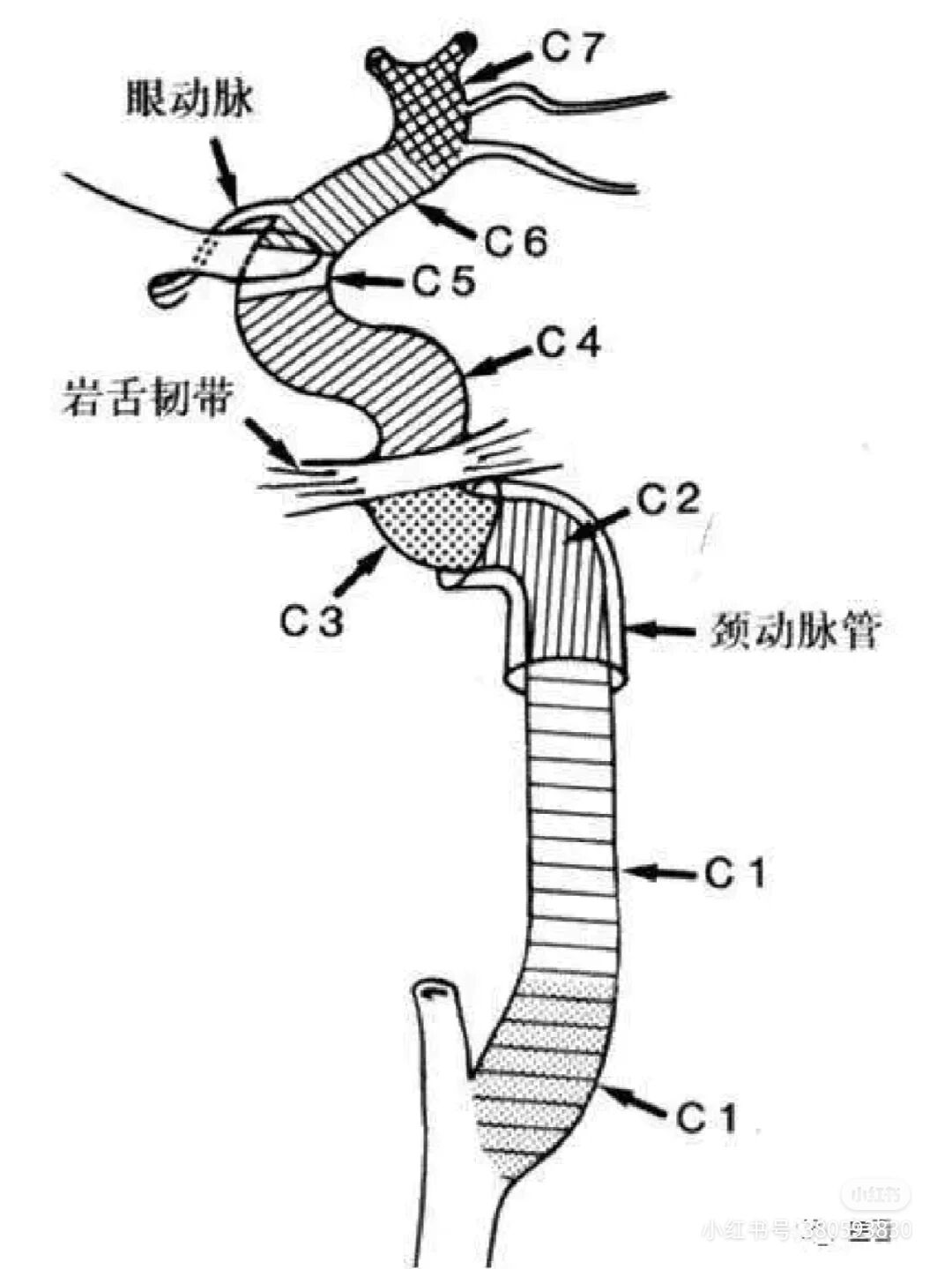 颈内动脉7分段示意图图片