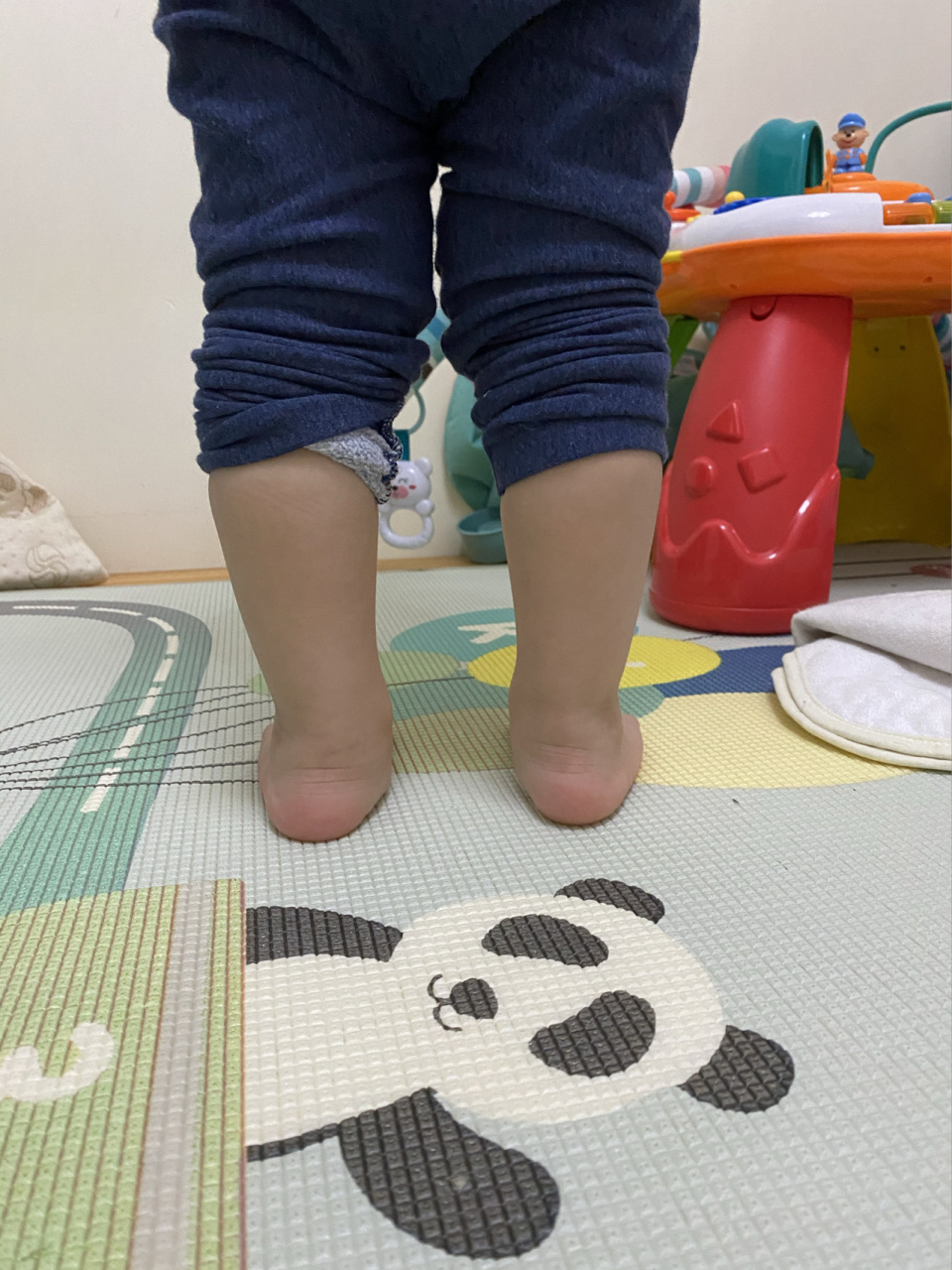 宝宝足外翻怎么办 小红书的宝妈们,麻烦帮我看一下宝宝是不是有点足