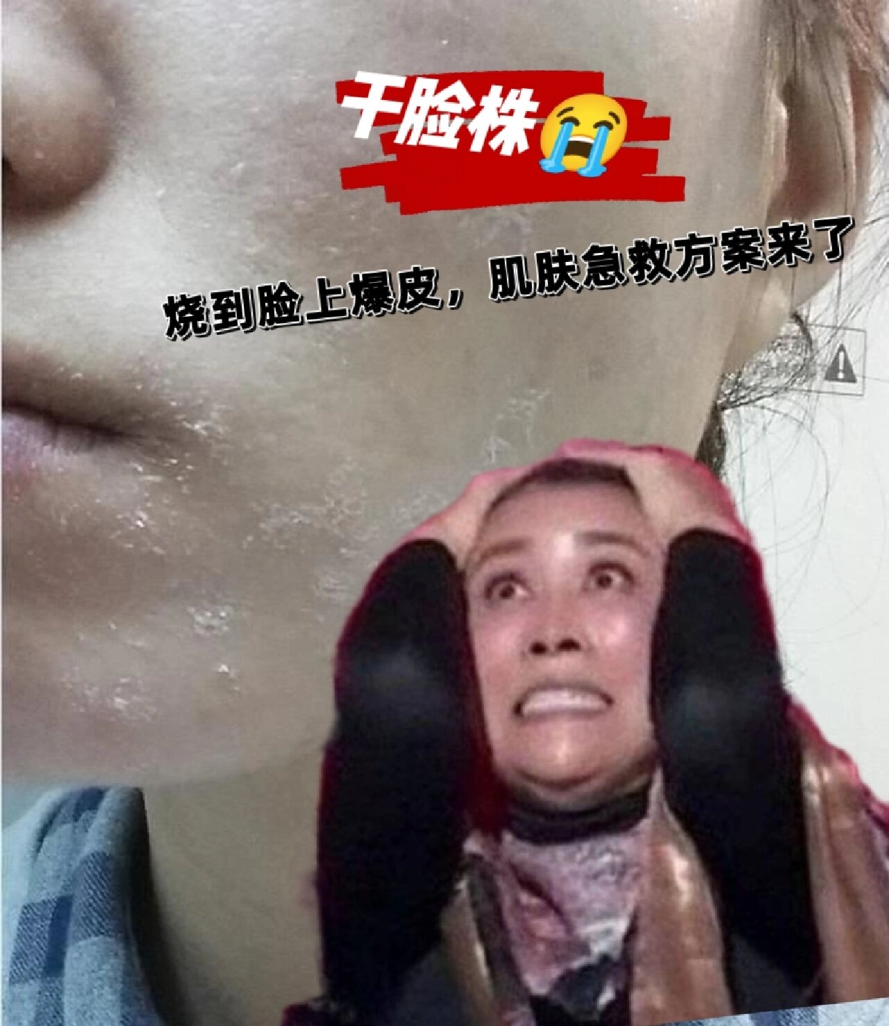 小心中招干脸株0101发烧到脸爆干!