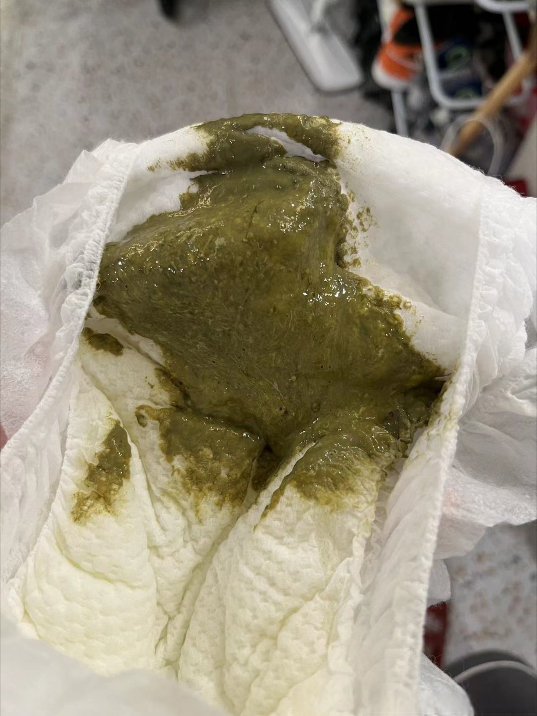 是儿科分享的一个经典便样  墨绿色的便便是新生儿的胎便