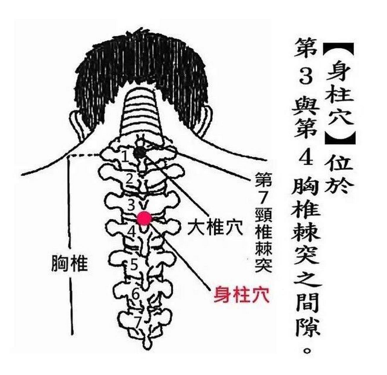 艾灸"身柱",增强抵抗力,助力孩子"长个儿" 身柱穴