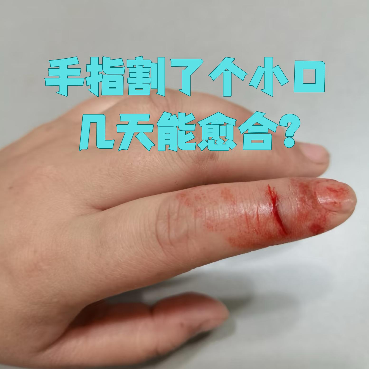手指割了个小口,一般7到14天就能愈合