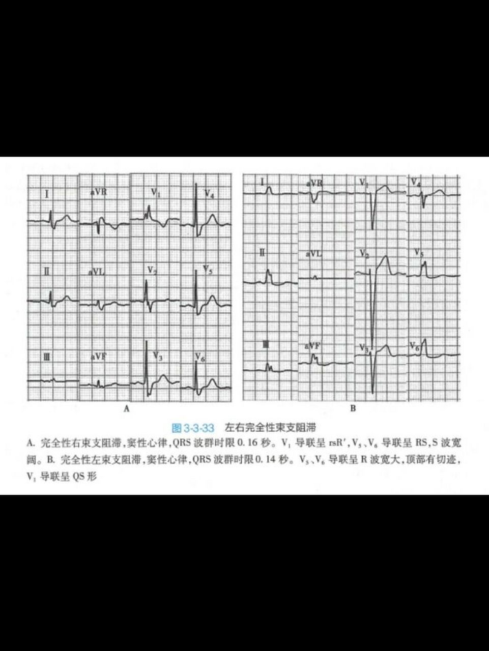 输入法打出心电图图片