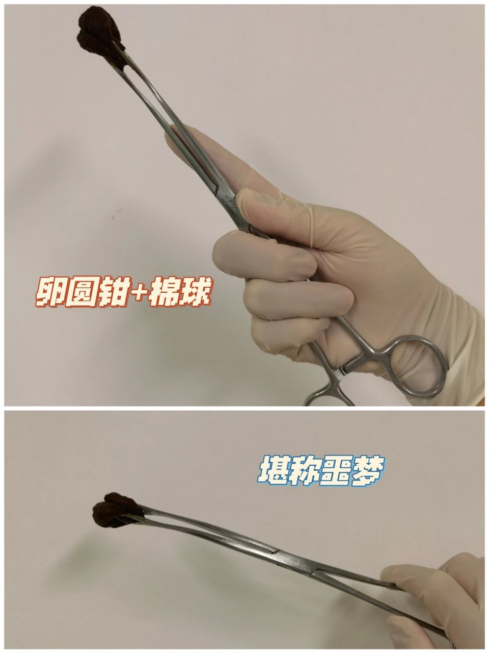 科普|浅聊一下妇科手术中的消毒问题 一般我们手术消毒分为两个步骤