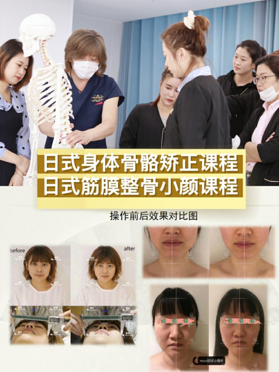 日式皮肤管理培训の日式筋膜整骨小颜课程 日本著名整