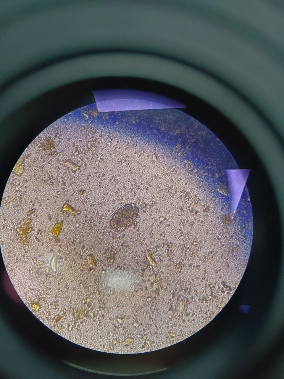 找到一典型钩虫卵 果然还是要靠显微镜94自己双眼找, 更清晰典型