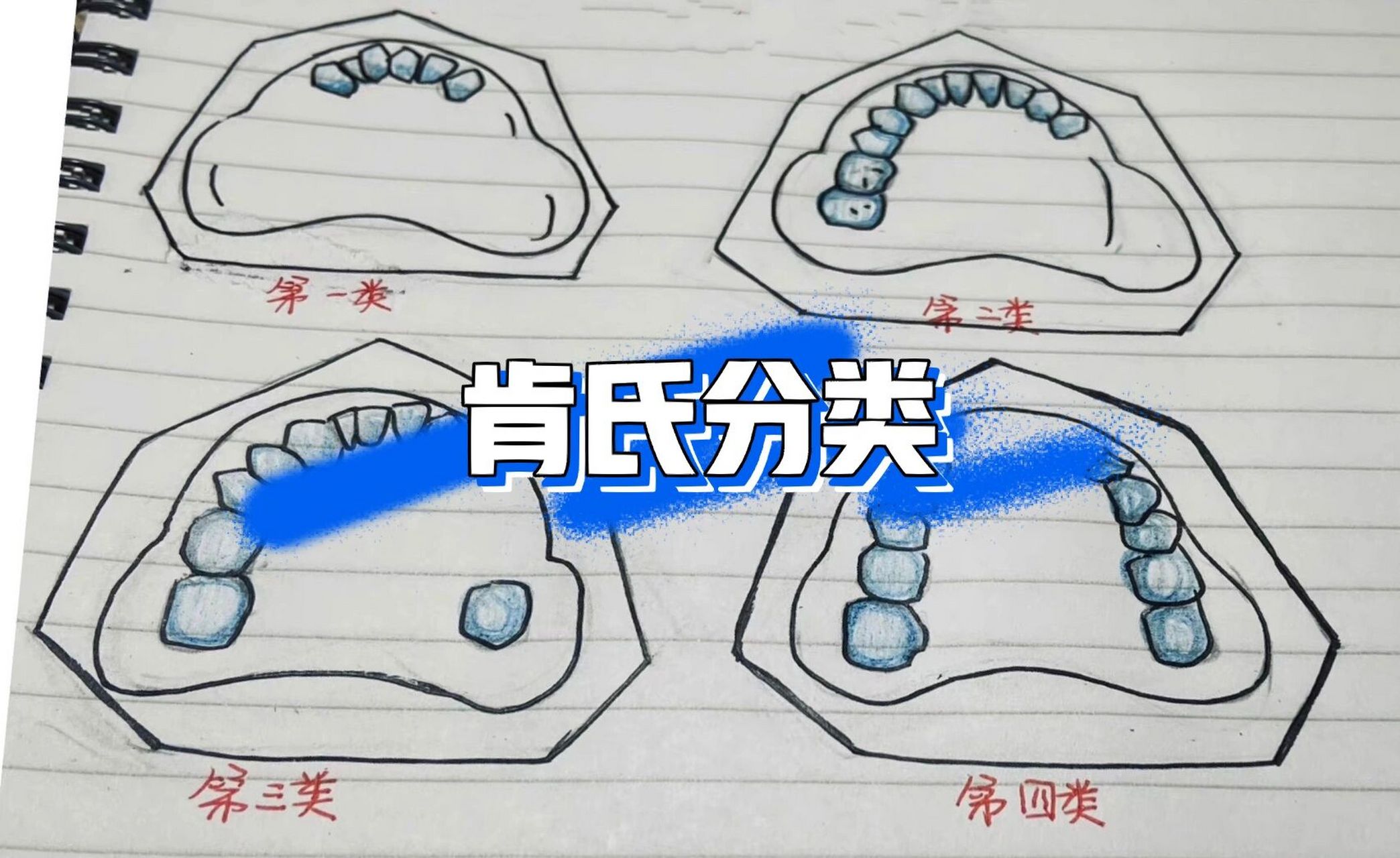 肯氏分类这样学很简单 肯氏分类是一个很上头的知识点啦也有不少同学