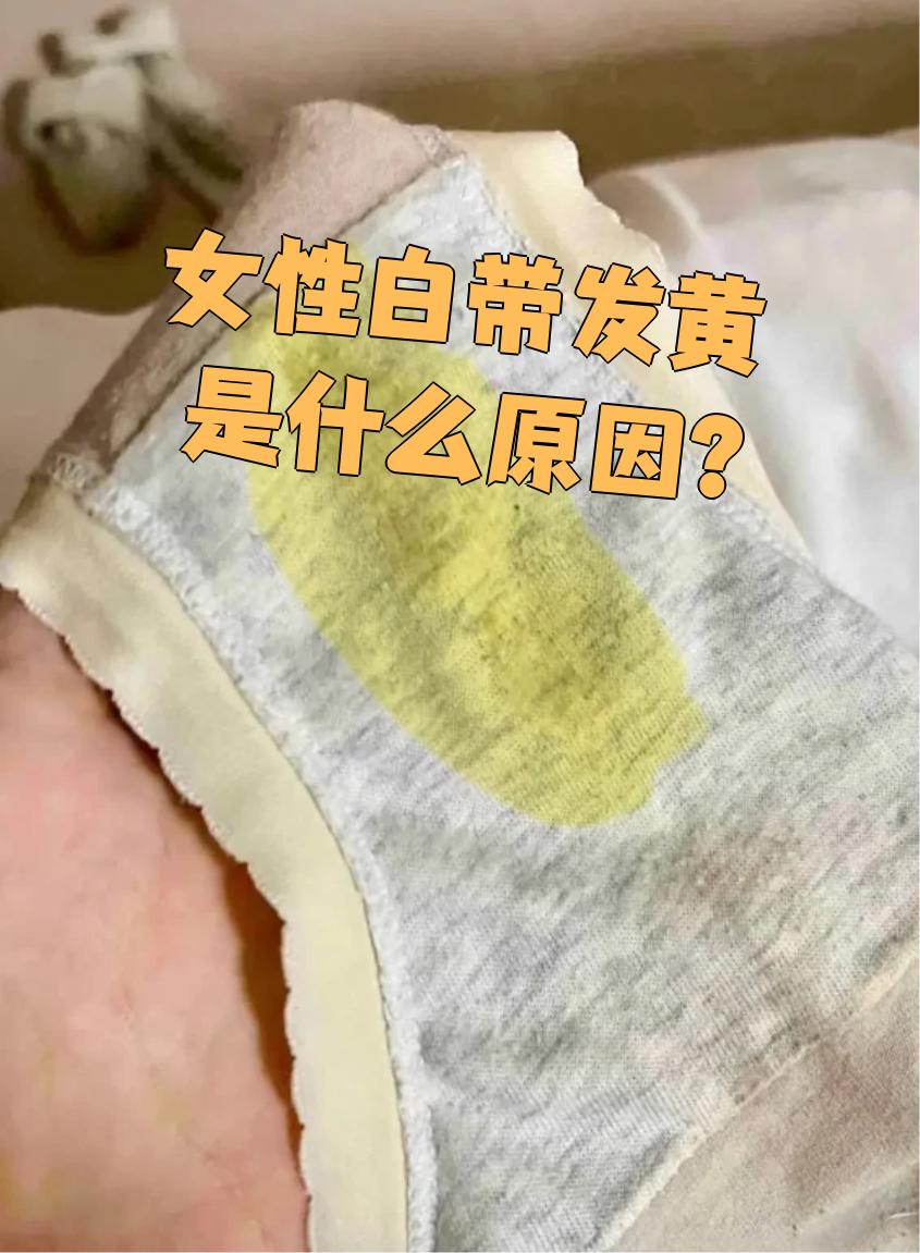 女性白带发黄一周前白带变黄现在来姨妈是什么原因来月经前白带黄色