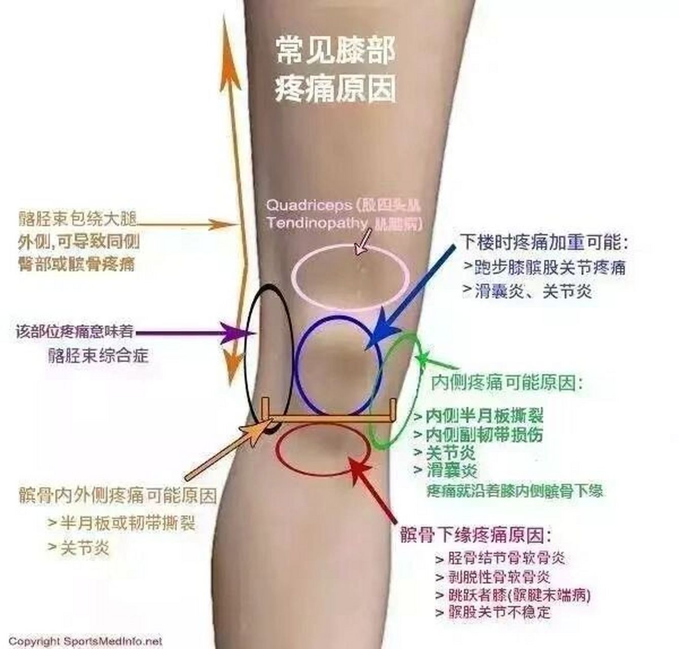 关于膝关节滑膜炎损伤  滑膜炎常见诱因:如骨质增生,关节炎,关节结核