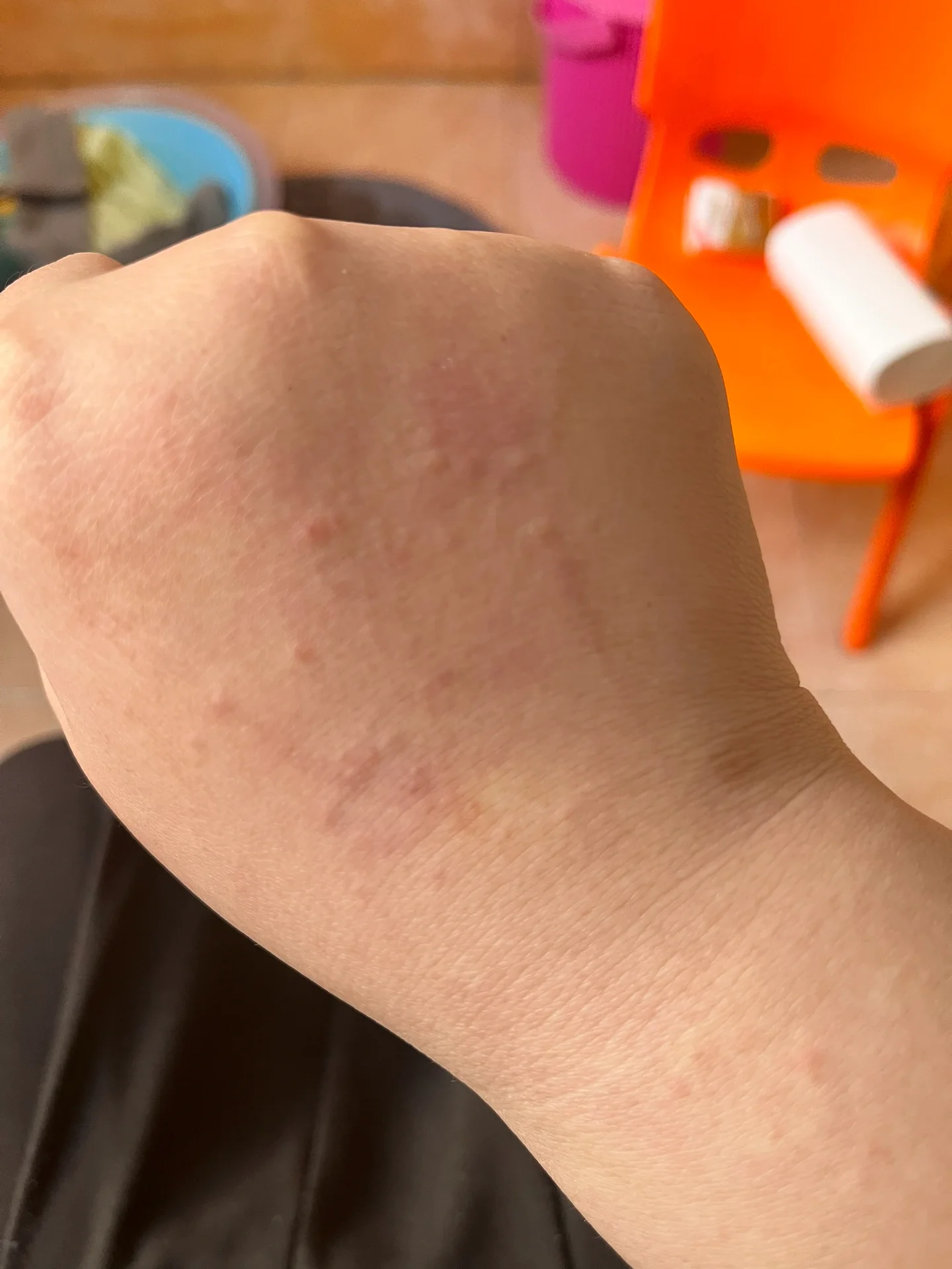 用完欧舒丹沐浴露后就过敏了 前两次用的时候耳朵痒我以为是巧合,这