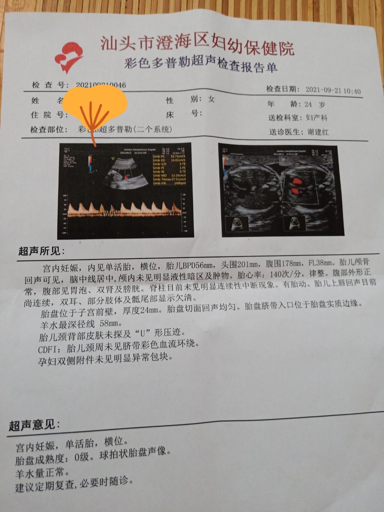 孕23周 1天 胎位不正,横位,不知道怎么会这样,医生跟我说这个周期还小