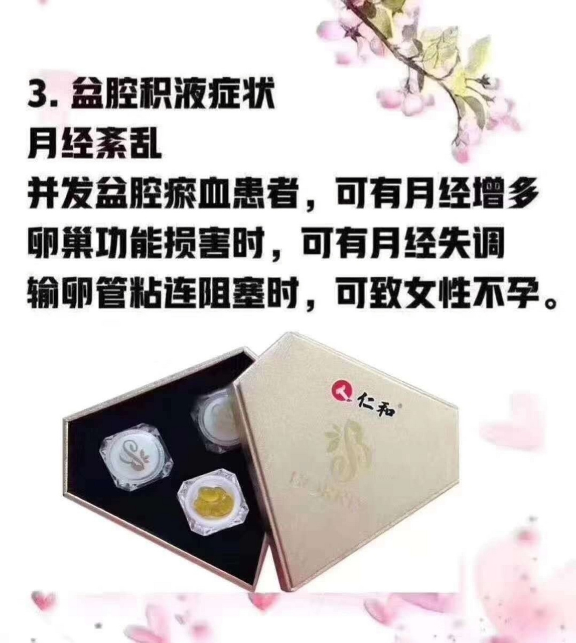 盆腔积液症状 盆腔积液症状166 下坠感,下腹,腰骶部疼痛 主要症状是