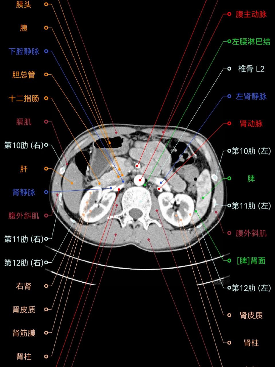 【影像解剖】腹部ct断层解剖图谱(app) 极力推荐的一个影像解剖学习