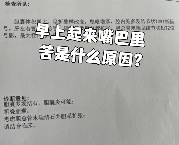 为什么早晨起来嘴巴总是苦苦的百科在线