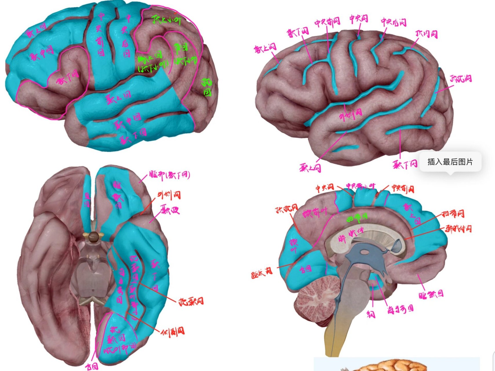解剖总结 大脑 脑沟脑回 脑室 脑池 大脑横断面解剖 大脑冠状面解剖