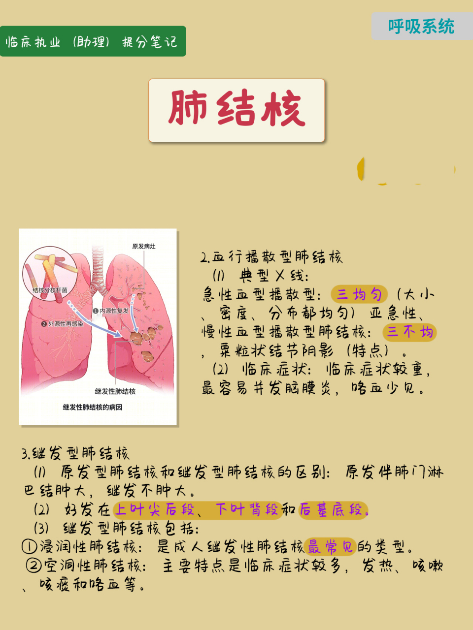 原发型肺结核 (1)题眼:肺门淋巴结肿大,哑铃征象,儿童.