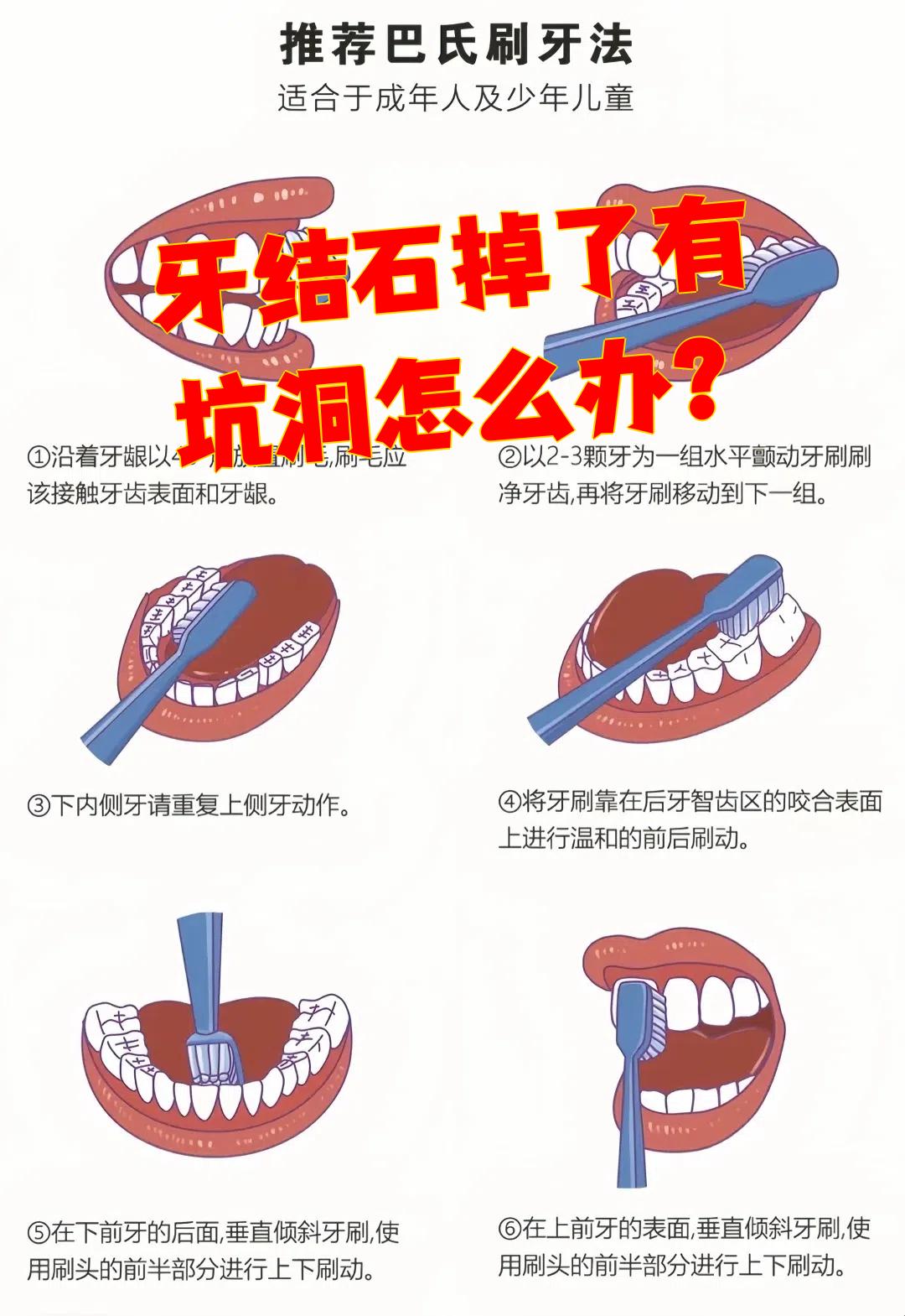 做梦梦到牙齿碎成小渣渣是什么意思,做梦梦到牙齿碎成小渣渣是什么意思啊