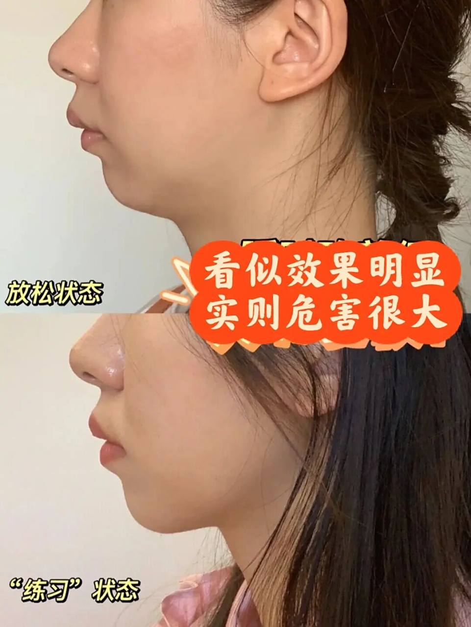 05求求了6015不要再做"改善下巴后缩训练"6015 网上铺天盖