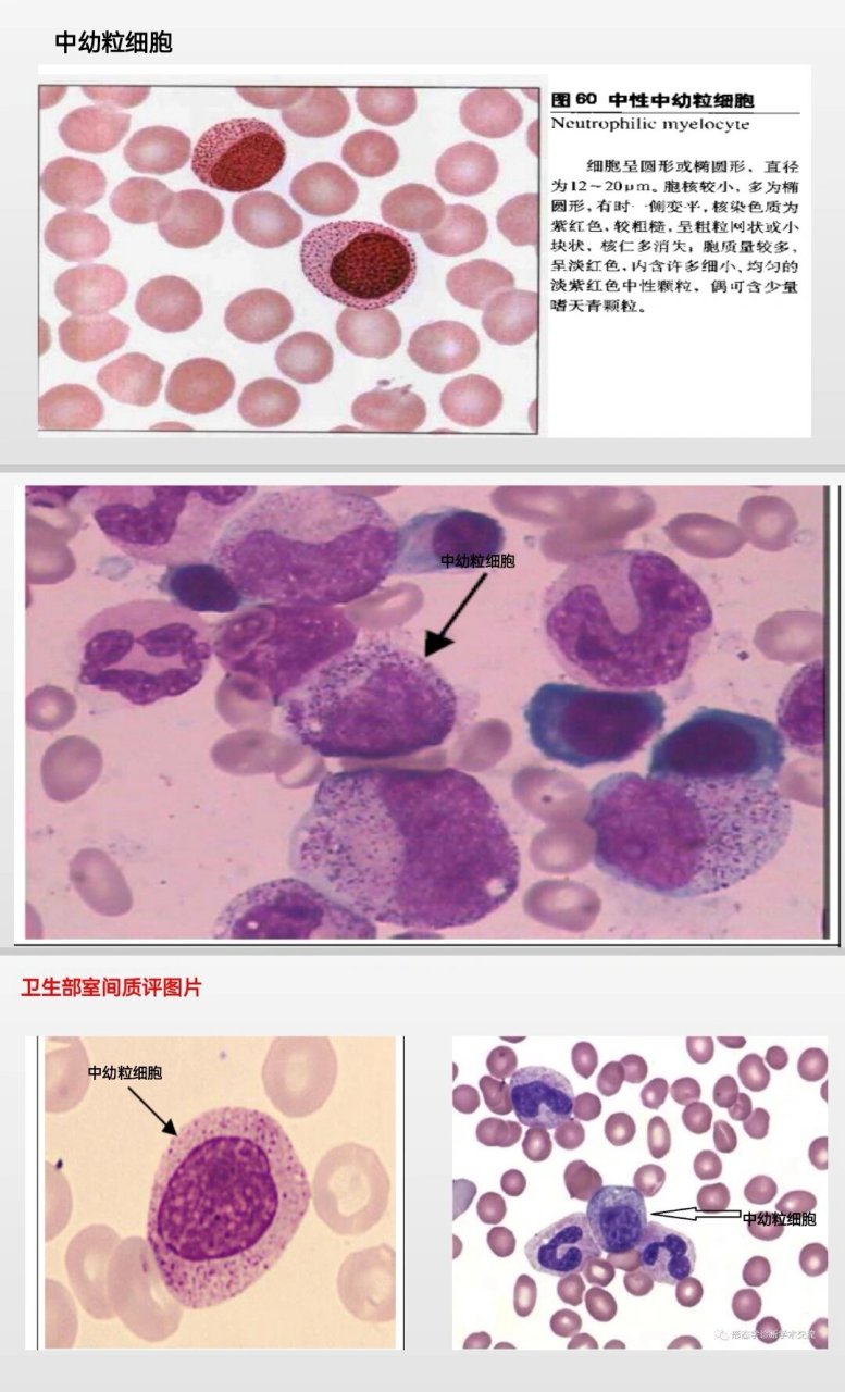 《临床血液学检查》 ②粒系:原粒→早幼粒→中幼粒(中性,嗜酸,嗜碱)