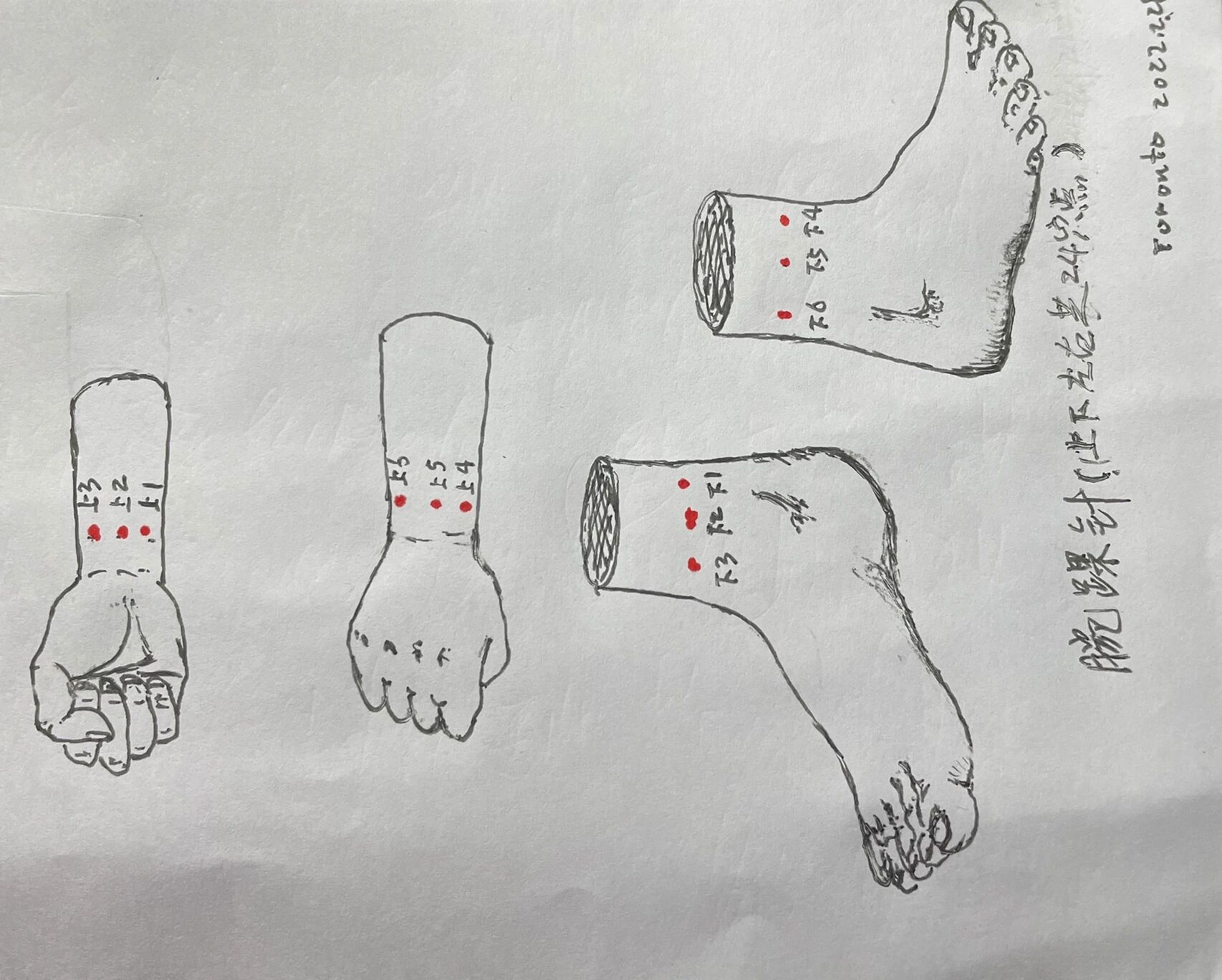 中西合璧腕踝针, 取穴按号要留神, 左右上下二十四, 分区延皮斜刺针