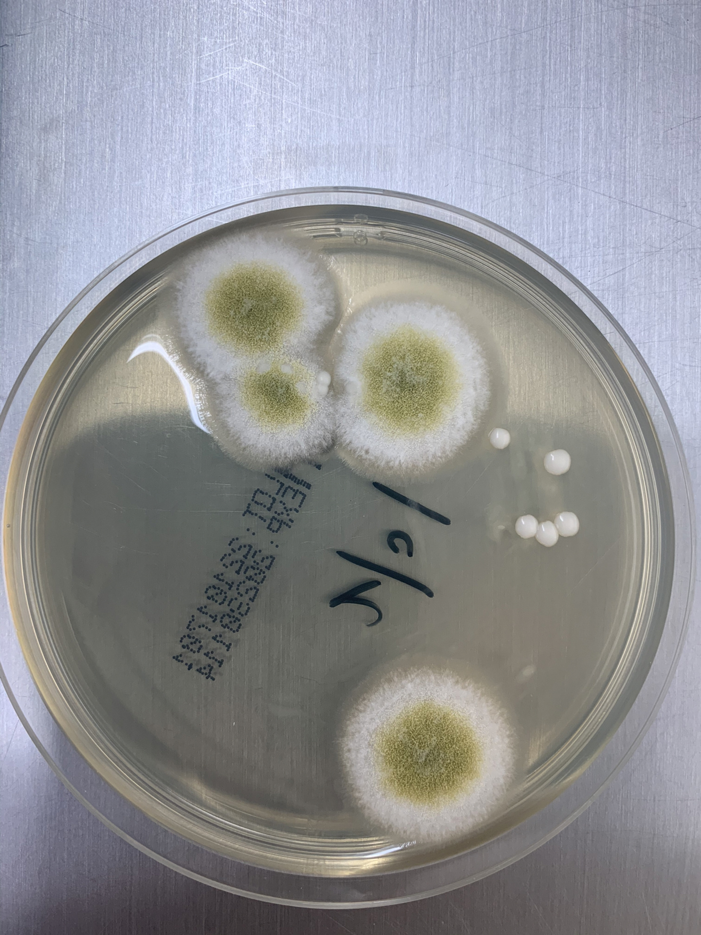 今天给大家分享一组真菌培养及镜下形态图