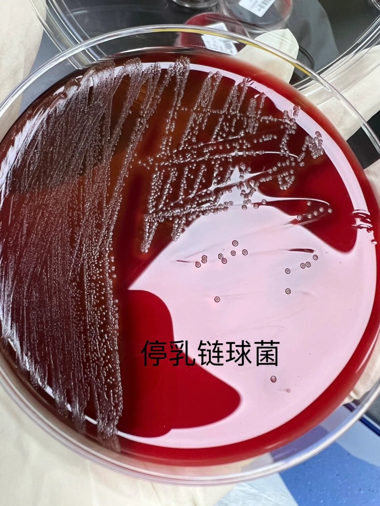 几种常见链球菌 最近培养出的几种链球菌.