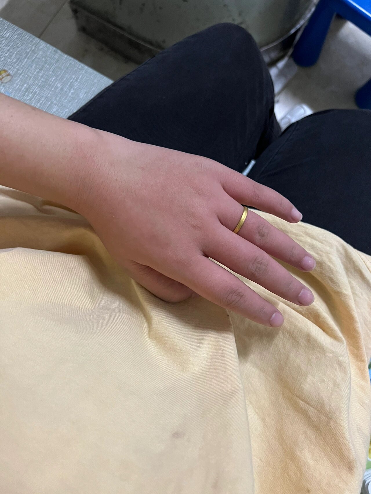 芋头过敏 就削了个芋头 就痒的不行了 恨不得剁手了要 涂了蚊虫止痒棒