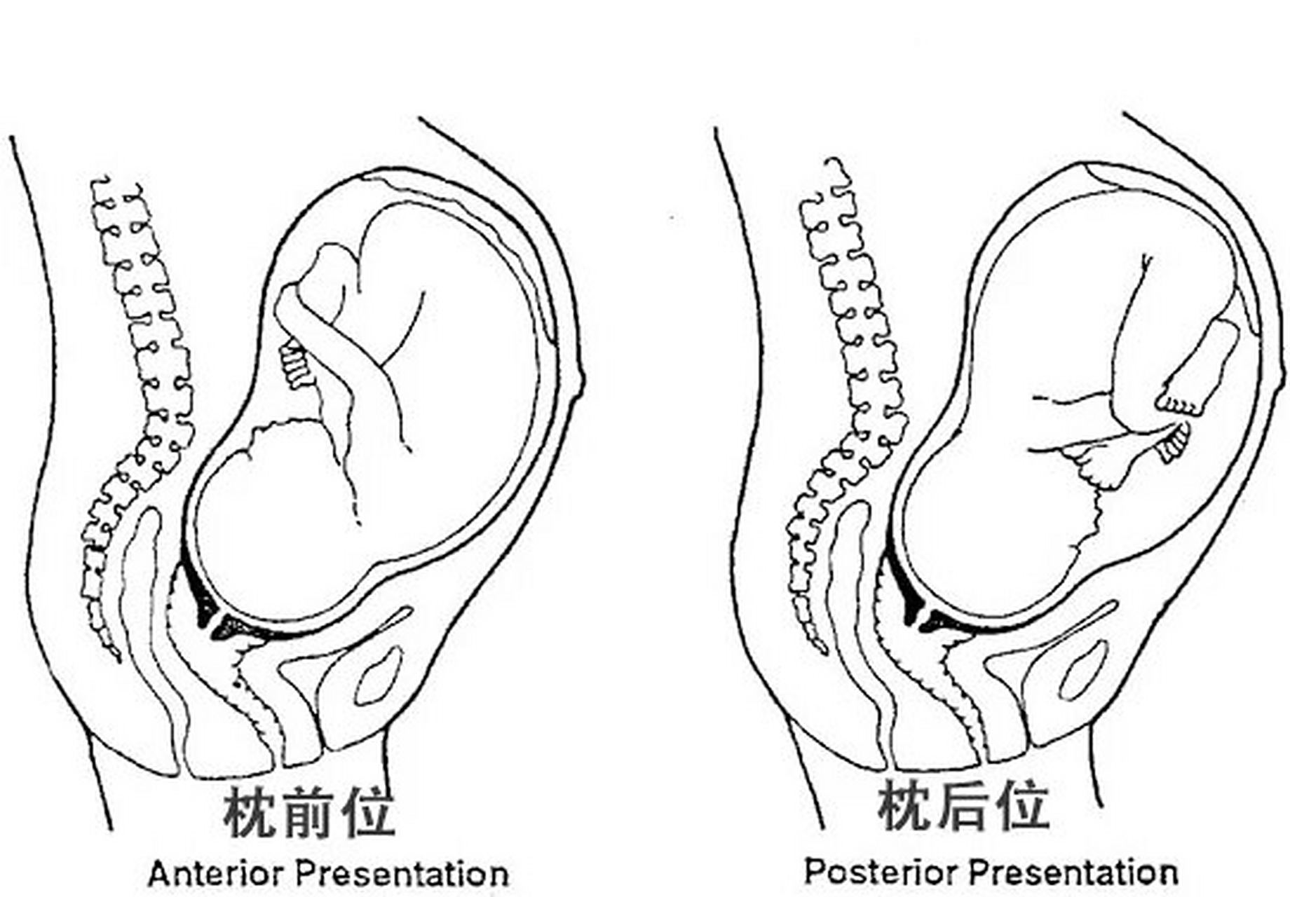 临床上经常有孕妇咨询,说b超单上写了胎儿是枕横位,或者枕后位.