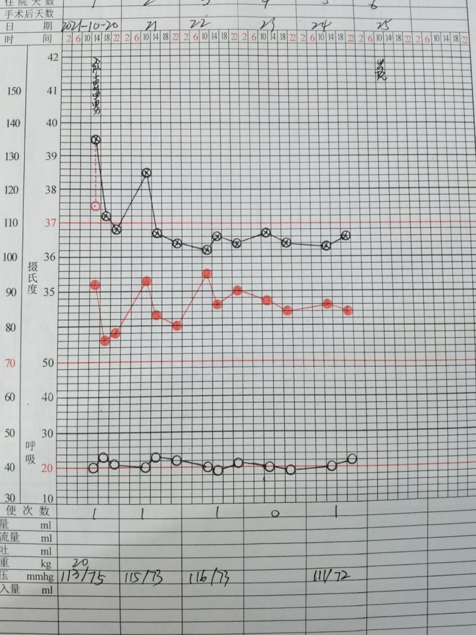 护士必备技能之画体温单 也许同样作为护士的你从来没见过这玩意儿