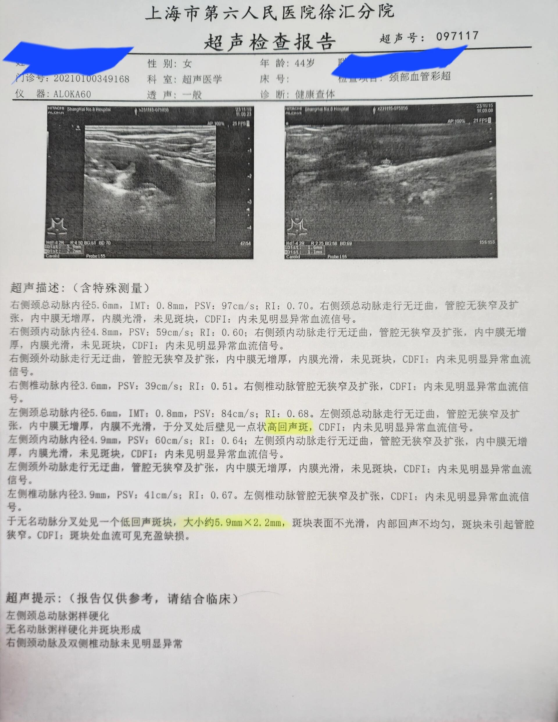 颈动脉做什么检查图片