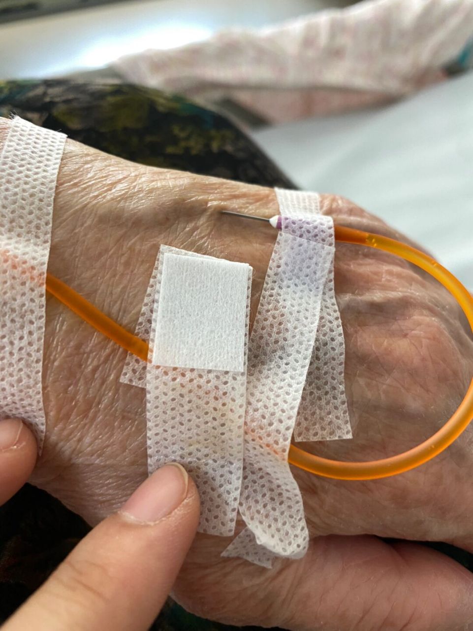 今天给一位70多岁的奶奶扎滴流,刚扎进去不一会,奶奶说有滋拉滋啦的