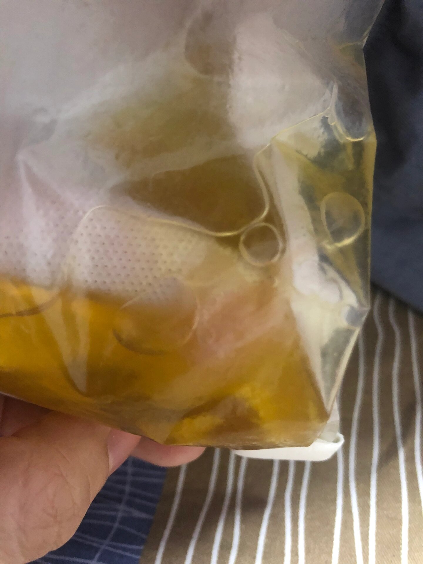 住院期间说液体是淋巴液和腹水,所以到底什么时候能好?