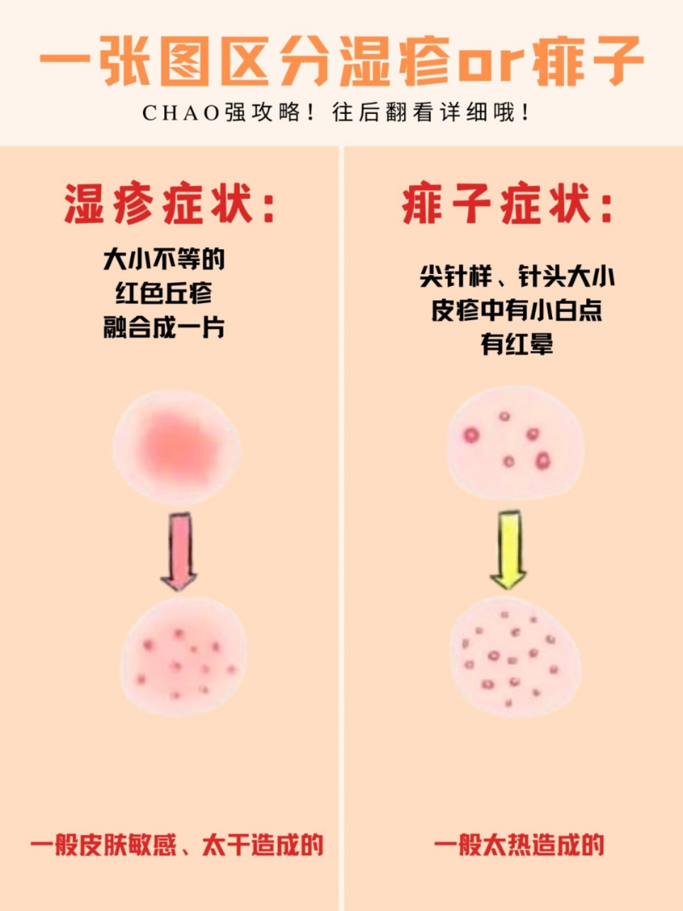 一張圖區分溼疹vs痱子!