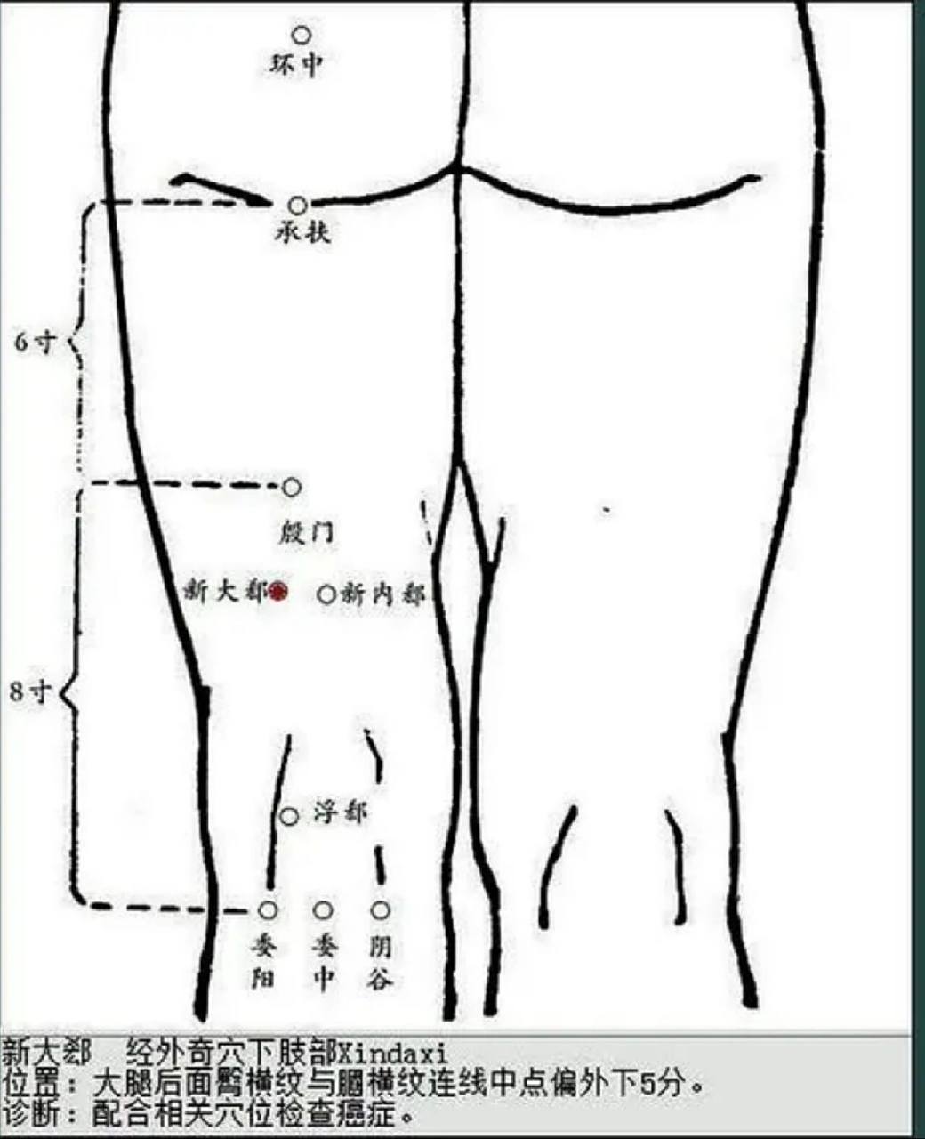 新大郄穴位于大腿后侧承扶穴与委中穴连线中点,外开5 分下5 分(同身
