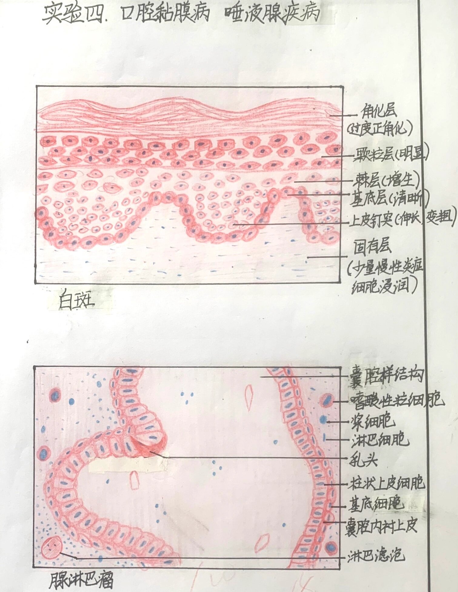 口腔组织病理学 实验报告 红蓝铅笔绘图