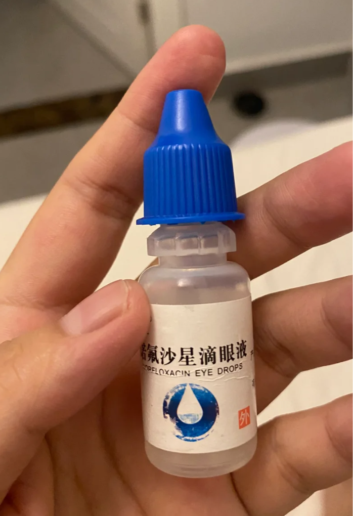 眼睛,眼角里有白色的东西可能是结膜炎或干眼症引