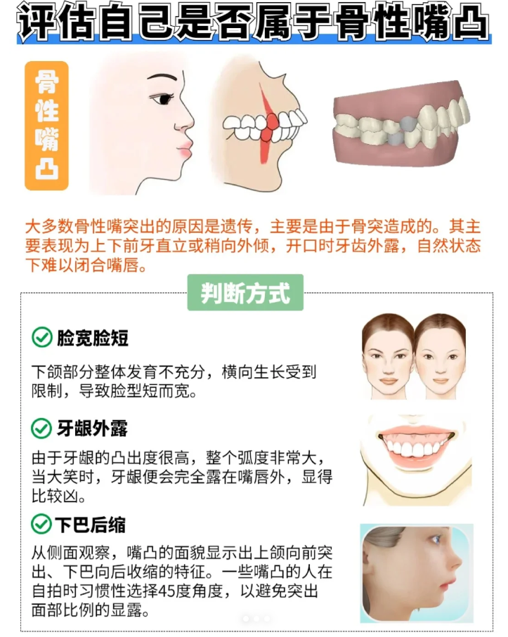 骨性嘴凸只做矫正不做正颌能不能行呢?